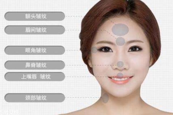 什么是肉毒素呢 肉毒素有什么作用呢 什么是肉毒素呢 肉毒素有什么作用呢