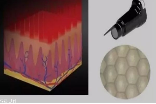 什么是皮秒呢 皮秒有什么作用呢 什么是皮秒呢 皮秒有什么作用呢