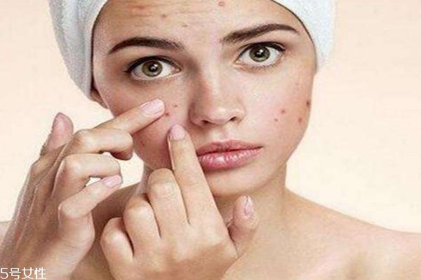 痘痘肌應(yīng)該用什么面膜呢 痘痘肌適合什么洗面奶呢 痘痘肌應(yīng)該用什么面膜呢 痘痘肌適合什么洗面奶呢