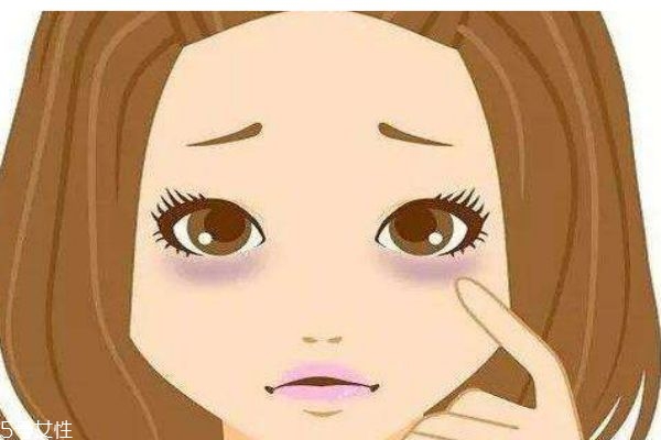 什么是黑眼圈呢 為什么會(huì)有黑眼圈呢