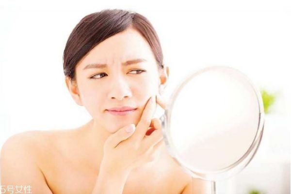 長(zhǎng)痘可以化妝嗎 又長(zhǎng)痘又要化妝怎么辦