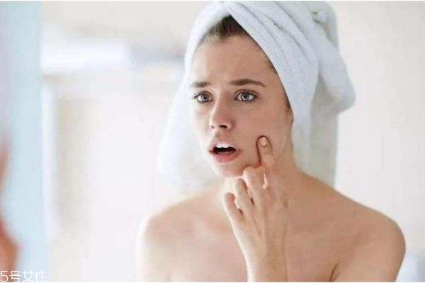 長(zhǎng)痘可以化妝嗎 又長(zhǎng)痘又要化妝怎么辦