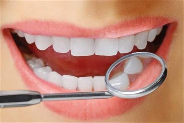 洗牙是自費(fèi)還是醫(yī)保卡 洗牙價(jià)格是多少錢