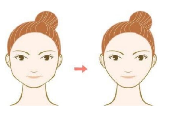 如何瘦臉呢 瘦臉應該吃什么呢 如何瘦臉呢 瘦臉應該吃什么呢