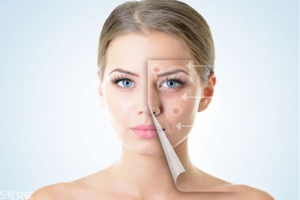太陽(yáng)曬斑怎么去除 怎么去除曬斑