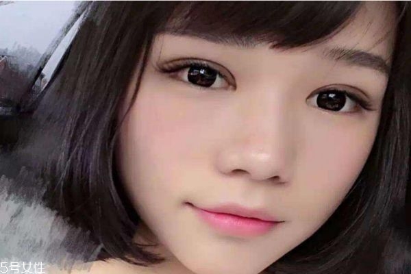 內(nèi)雙割雙眼皮容易嗎 割雙眼皮有什么注意的呢