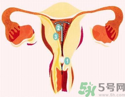 上環(huán)的最佳時間是什么時候？上環(huán)的壞處是什么？