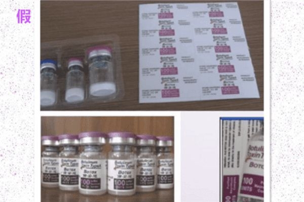 保妥適瘦臉針怎么樣 瘦臉針美國(guó)保妥適真假辨別 保妥適瘦臉針怎么樣 瘦臉針美國(guó)保妥適真假辨別