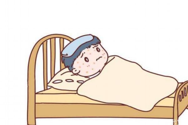 小兒得麻疹有什么癥狀呢 如何預(yù)防小兒麻疹呢 小兒得麻疹有什么癥狀呢 如何預(yù)防小兒麻疹呢