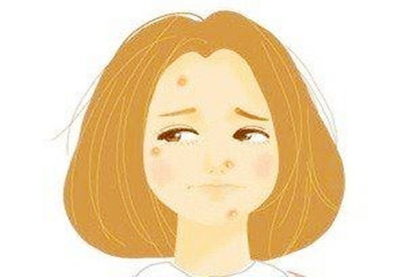 臉上剛擠完痘怎么辦 臉上剛擠完痘要注意什么 臉上剛擠完痘怎么辦 臉上剛擠完痘要注意什么