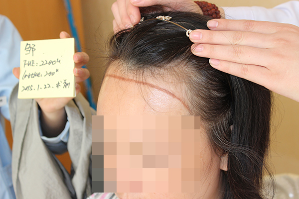 掉頭發(fā)很厲害怎么辦 掉頭發(fā)和脫發(fā)有什么區(qū)別 掉頭發(fā)很厲害怎么辦 掉頭發(fā)和脫發(fā)有什么區(qū)別