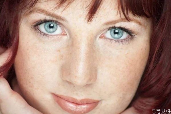 什么是色斑呢 為什么臉上會(huì)出現(xiàn)色斑呢