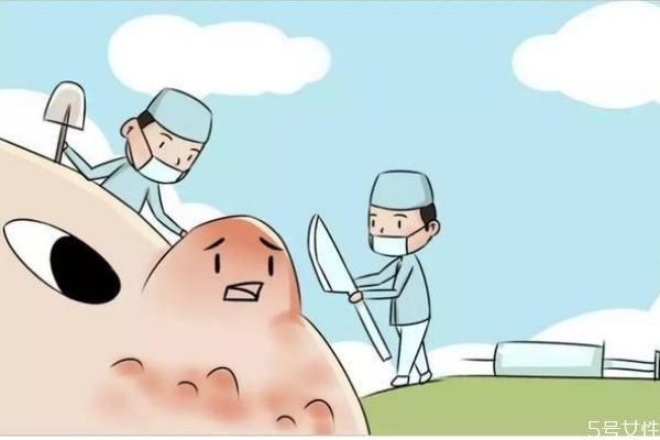 痘印可以去除嗎 痘印去除的辦法有什么呢 痘印可以去除嗎 痘印去除的辦法有什么呢