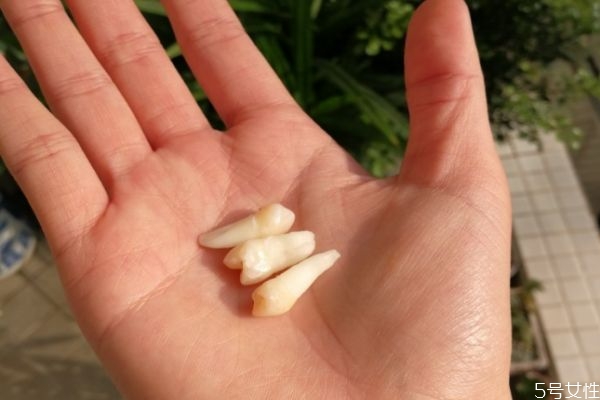 拔牙要拔牙根嗎?牙根要拔掉嗎 拔牙要拔牙根嗎?牙根要拔掉嗎