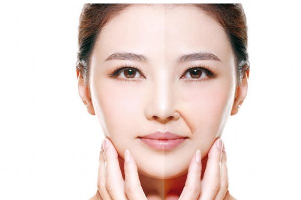 為什么會有法令紋呢 如何預(yù)防法令紋呢 為什么會有法令紋呢 如何預(yù)防法令紋呢