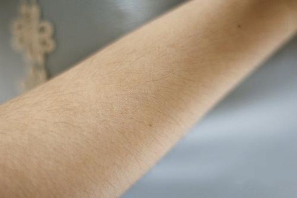 唇毛激光脫毛還會(huì)長(zhǎng)嗎 激光脫毛痛嗎