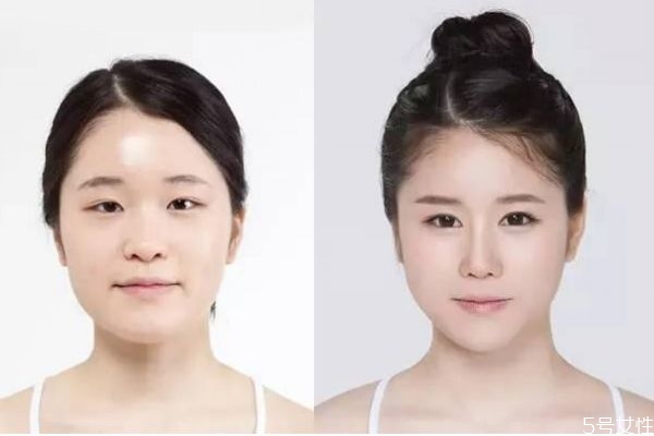 墊鼻子有什么危害呢 墊鼻子老了以后會怎么樣呢 墊鼻子有什么危害呢 墊鼻子老了以后會怎么樣呢