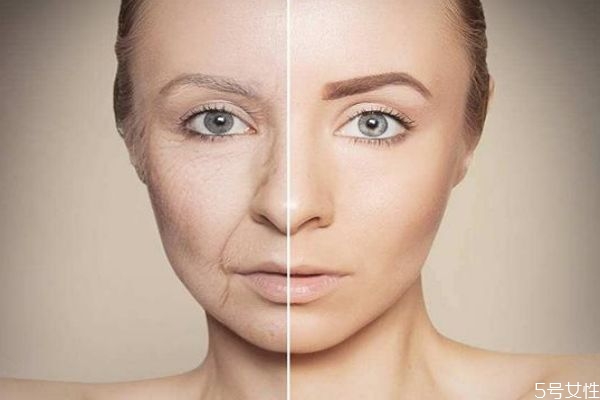 臉部松弛下垂怎么辦 如何改善臉部松弛下垂