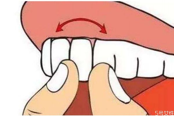 牙齒松動(dòng)比較疼怎么辦呢 牙齒松動(dòng)需要拔牙嗎