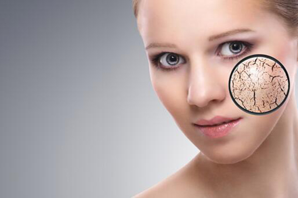 曬斑是怎么形成的 日常怎么去除曬斑 曬斑是怎么形成的 日常怎么去除曬斑