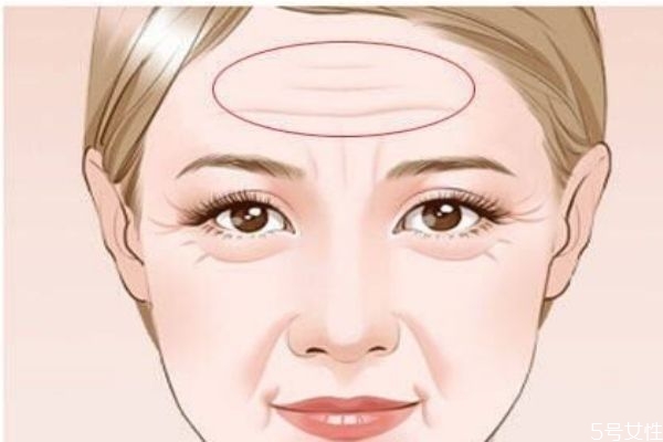 造成抬頭紋的原因有什么呢 為什么會(huì)有抬頭紋呢 造成抬頭紋的原因有什么呢 為什么會(huì)有抬頭紋呢
