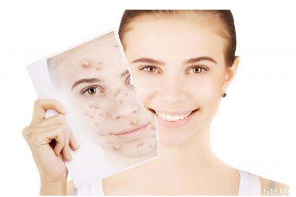 為什么臉上會長包呢 長包的原因是什么呢 為什么臉上會長包呢 長包的原因是什么呢