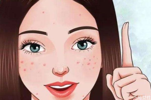 為什么臉上會長包呢 長包的原因是什么呢 為什么臉上會長包呢 長包的原因是什么呢