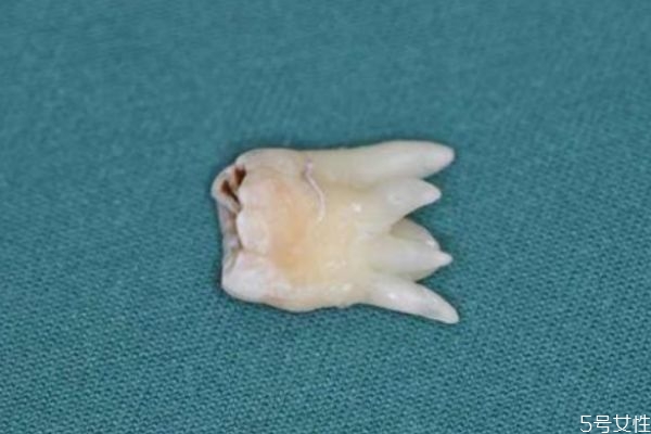 什么是智齒呢 每個(gè)人都會(huì)長(zhǎng)智齒嗎 什么是智齒呢 每個(gè)人都會(huì)長(zhǎng)智齒嗎