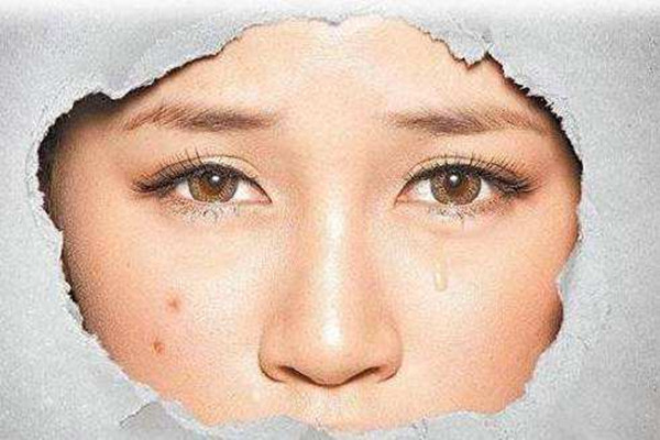 痘印消失的時間跟膚色有關(guān)嗎 痘印要多久能消除 痘印消失的時間跟膚色有關(guān)嗎 痘印要多久能消除