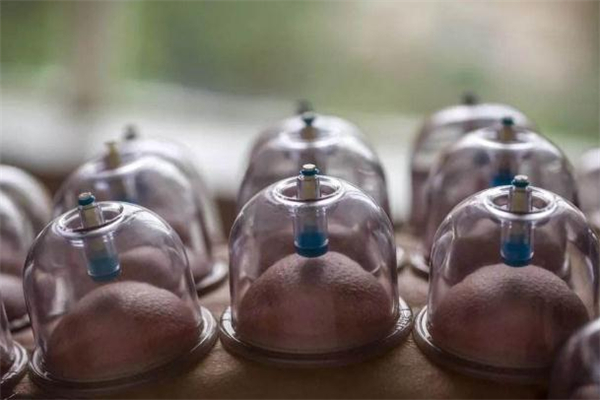 拔罐減肥拔哪些部位 拔罐減肥有科學依據(jù)嗎