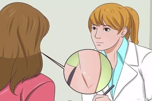 狐臭的表現(xiàn)有哪些 如何預防狐臭的發(fā)生