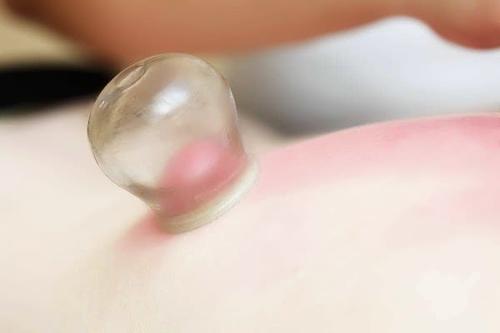 冬季拔火罐減肥有效果嗎 冬季拔火罐減肥好嗎 冬季拔火罐減肥有效果嗎 冬季拔火罐減肥好嗎