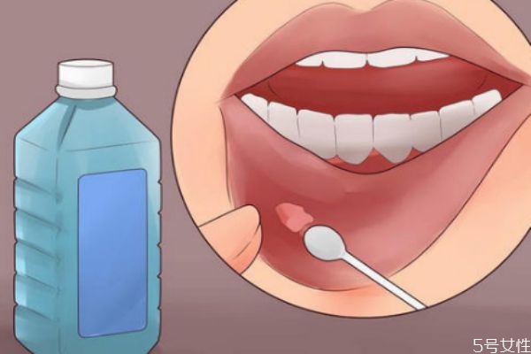 口腔潰瘍多長時(shí)間自愈 口腔潰瘍吃什么水果