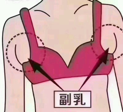 什么是副乳 怎么判斷自己有沒(méi)有副乳
