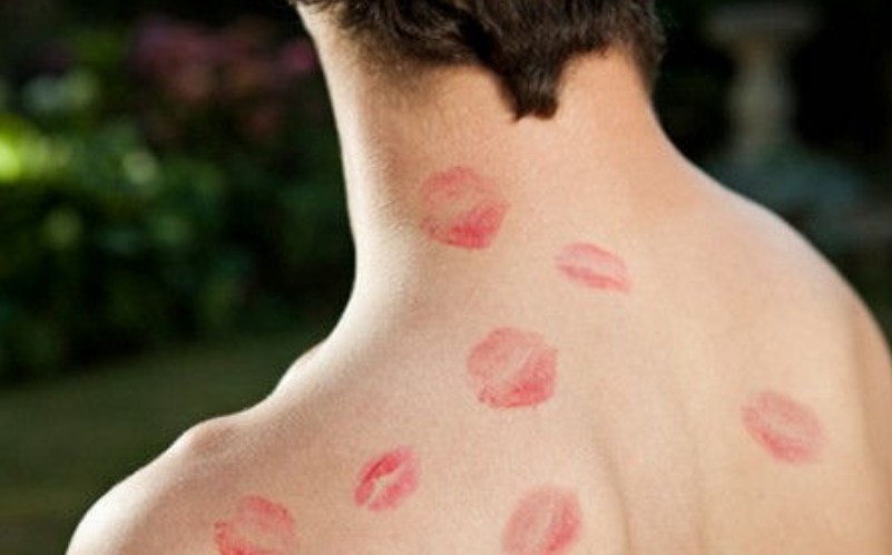 吻痕是熱敷還是冷敷 吻痕多久會(huì)消失 吻痕是熱敷還是冷敷 吻痕多久會(huì)消失