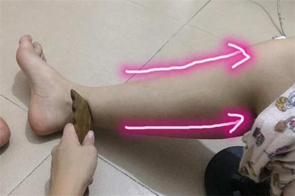 刮痧減肥的原理 刮痧減肥的正確方法 刮痧減肥的原理 刮痧減肥的正確方法