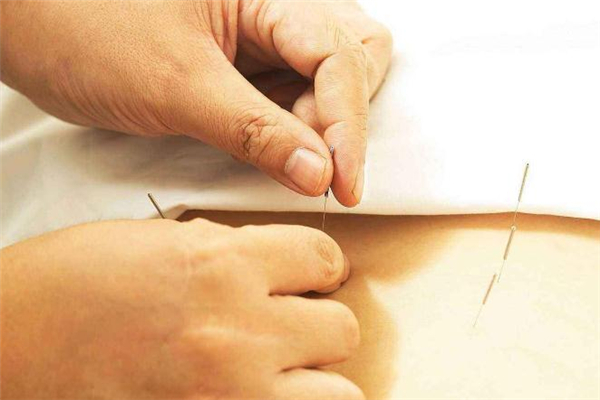 針灸減肥一個(gè)療程多少錢(qián) 針灸減肥一個(gè)療程是幾天