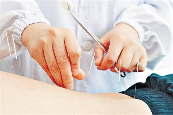 經(jīng)期可以針灸減肥嗎 針灸減肥會導致月經(jīng)推遲嗎