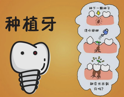 種植牙齒的壽命有多長 種植牙齒多久能恢復 種植牙齒的壽命有多長 種植牙齒多久能恢復