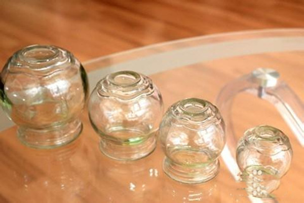 拔罐是如何達到減肥效果的 拔罐減肥需要控制飲食嗎 拔罐是如何達到減肥效果的 拔罐減肥需要控制飲食嗎