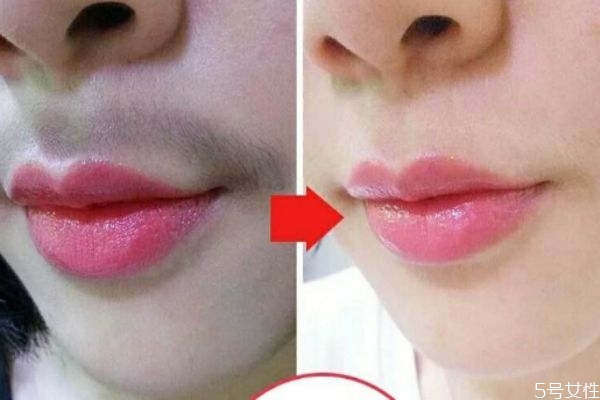 女性造成唇毛的原因是什么 為什么女性會(huì)長(zhǎng)唇毛