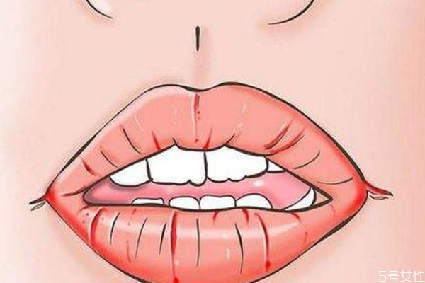嘴唇很干燥為什么 怎么給嘴唇快速補水 嘴唇很干燥為什么 怎么給嘴唇快速補水