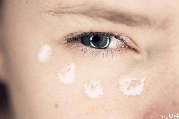 眼部干紋是怎么形成的 為什么會造成眼部干紋 眼部干紋是怎么形成的 為什么會造成眼部干紋