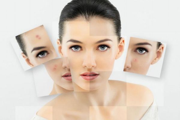 針清痘痘后多久會好 針清的注意事項(xiàng)