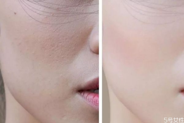 洋甘菊的護(hù)膚的作用 洋甘菊護(hù)膚的功效 洋甘菊的護(hù)膚的作用 洋甘菊護(hù)膚的功效