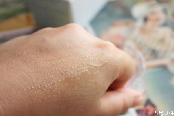 皮膚曬傷蛻皮怎么辦 皮膚曬傷蛻皮怎么修復 皮膚曬傷蛻皮怎么辦 皮膚曬傷蛻皮怎么修復