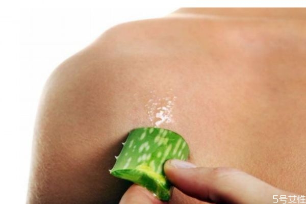 皮膚曬傷蛻皮怎么辦 皮膚曬傷蛻皮怎么修復 皮膚曬傷蛻皮怎么辦 皮膚曬傷蛻皮怎么修復