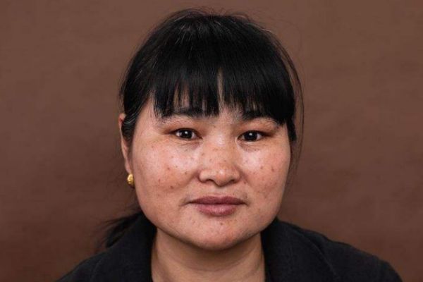 角質(zhì)層薄會容易長斑嗎 長斑和角質(zhì)層薄有關(guān)系嗎 角質(zhì)層薄會容易長斑嗎 長斑和角質(zhì)層薄有關(guān)系嗎