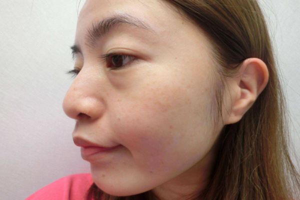 角質(zhì)層變厚的原因 為什么角質(zhì)層會變厚 角質(zhì)層變厚的原因 為什么角質(zhì)層會變厚