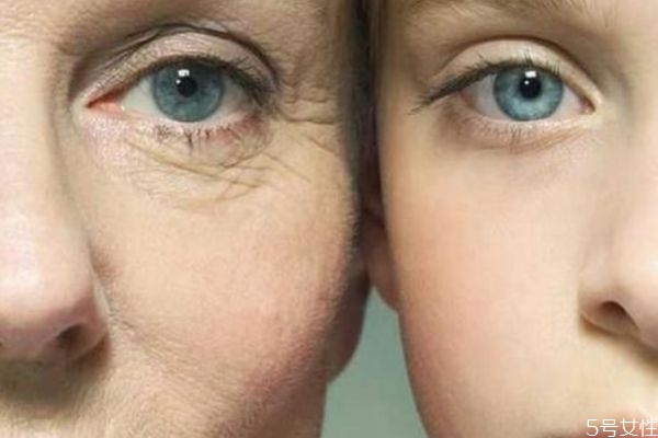 如何減少臉上皺紋 減少臉上皺紋的方法 如何減少臉上皺紋 減少臉上皺紋的方法